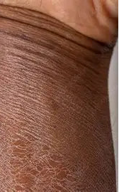 Close-up of a person's leg with brown skin texture.